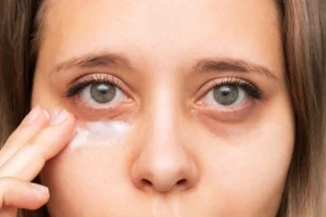 7+ Cách phòng tránh quầng thâm mắt hiệu quả
